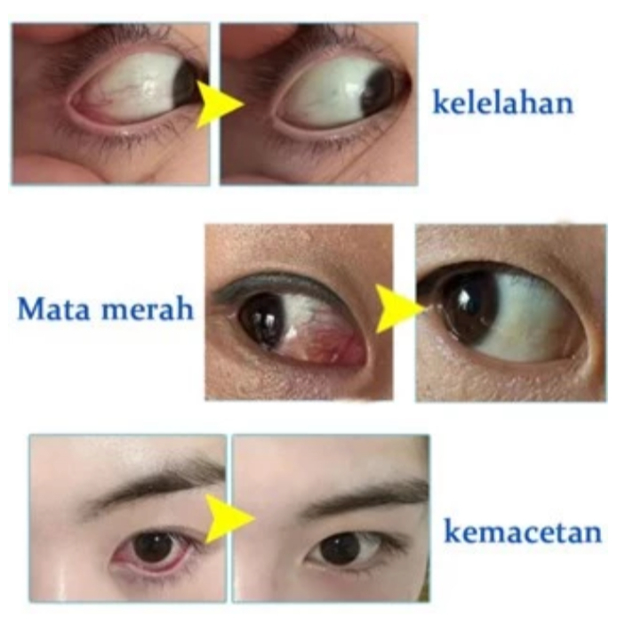 Hasil Pemakaian Before After