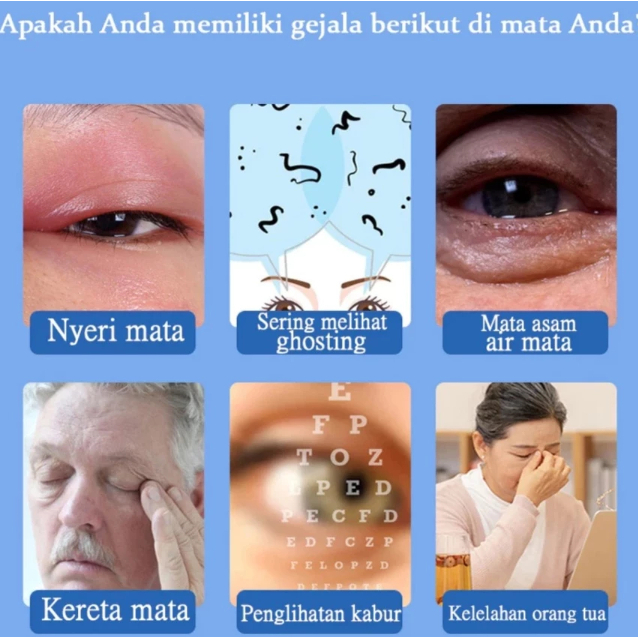 Gejala Mata Lengkap